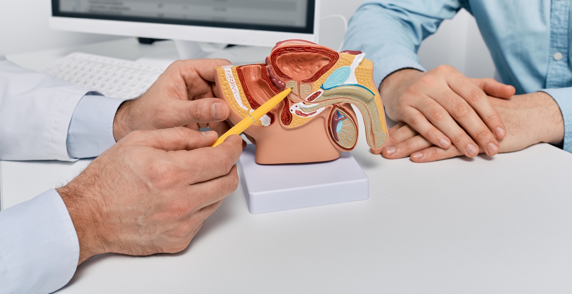 Doctor consulting man patient with suspected prostate cancer using male reproductive system model while visit in urology clinic. Prostate problems and treatment